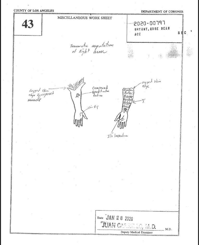 autopsy of kobe bryan