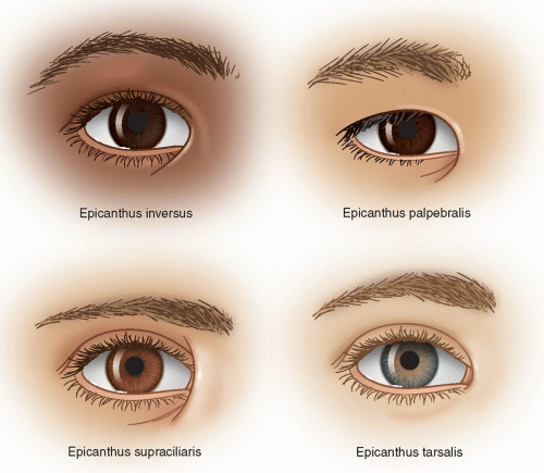 epicanthic fold sami eyes