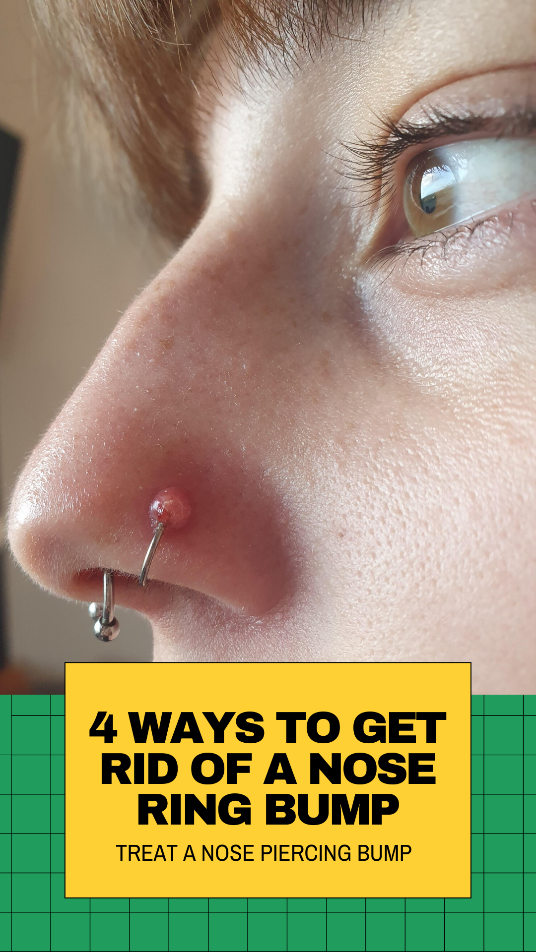 how to get rid of nose ring infection