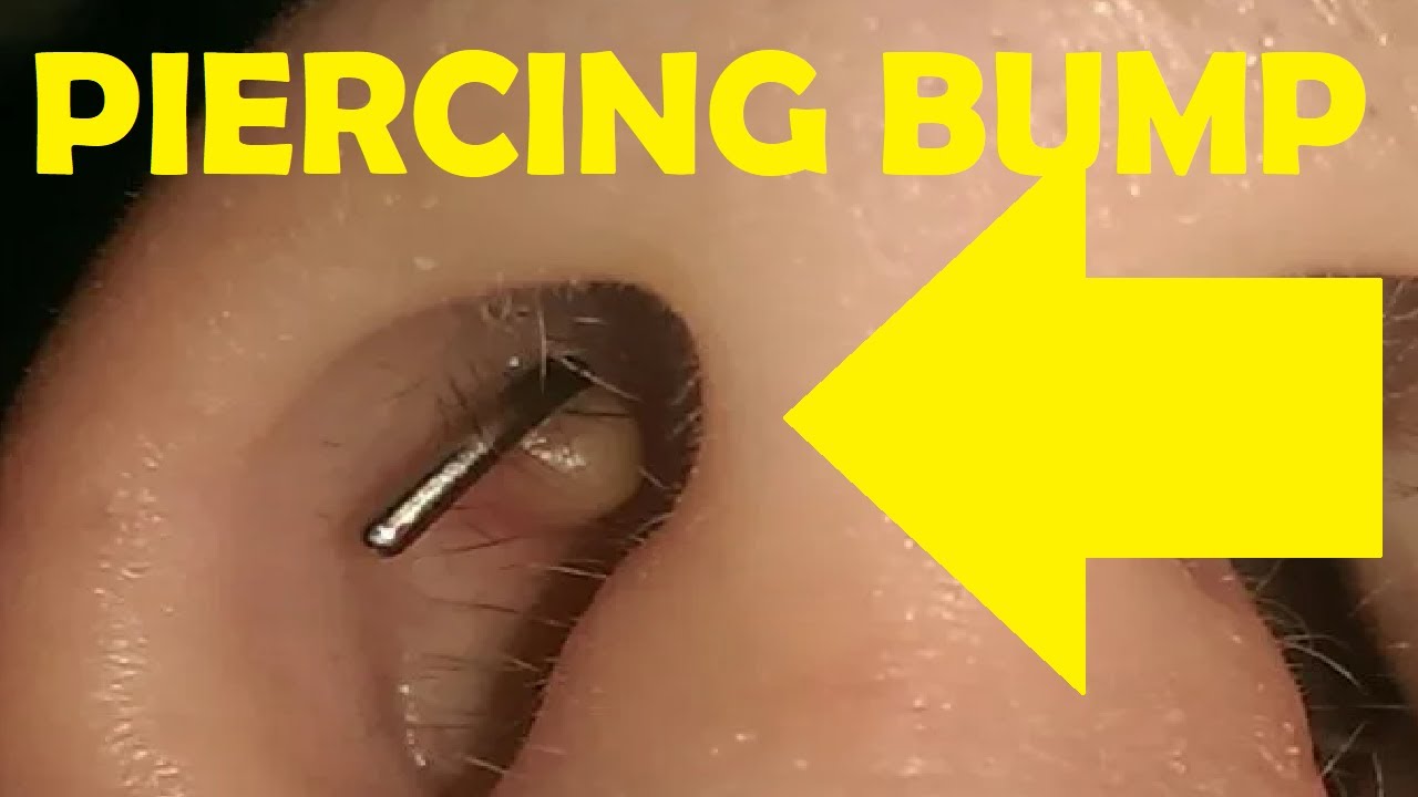 bump inside nose from piercing