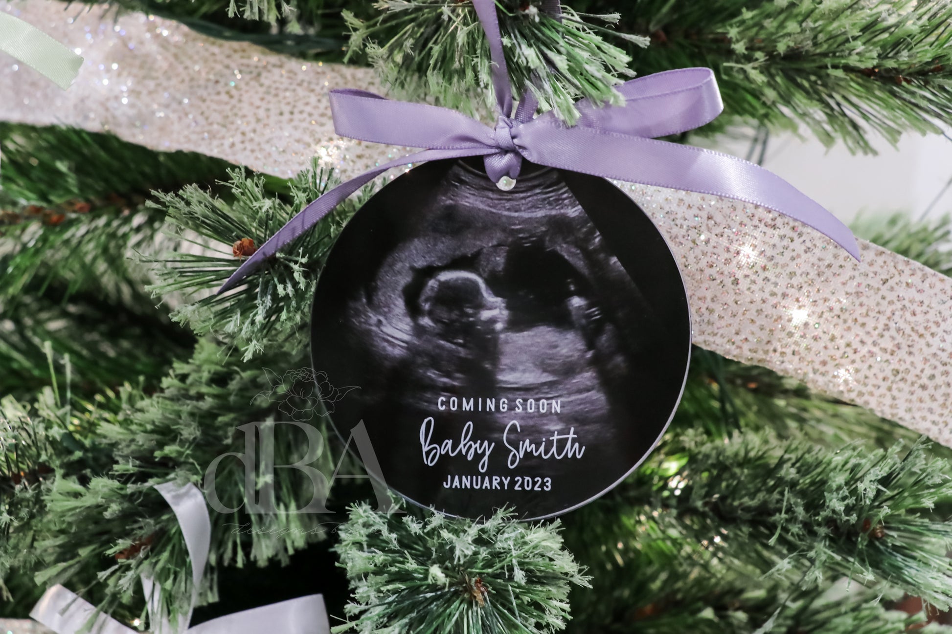 ultrasound ornament