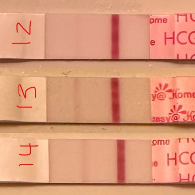 miscarriage chemical pregnancy line progression