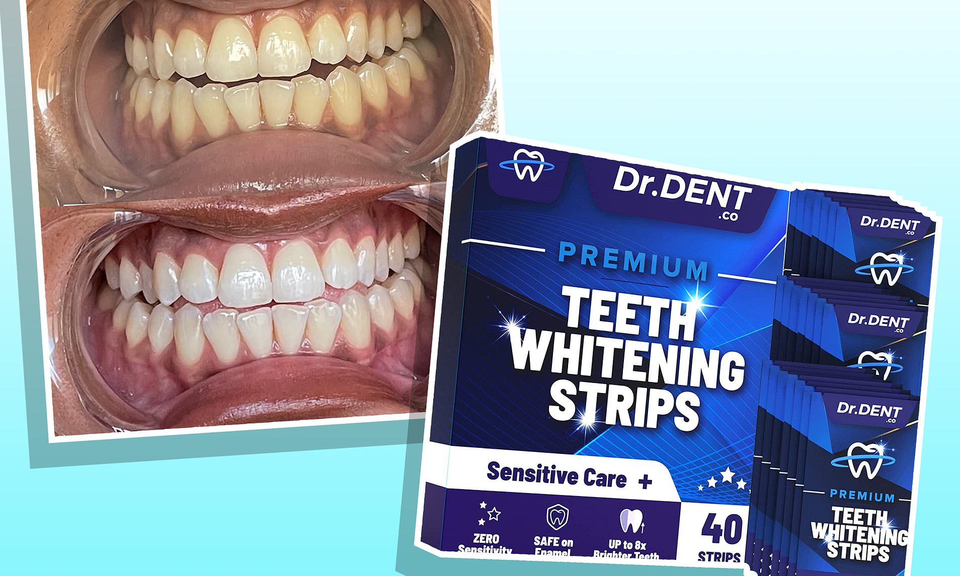dr dent teeth whitening strips