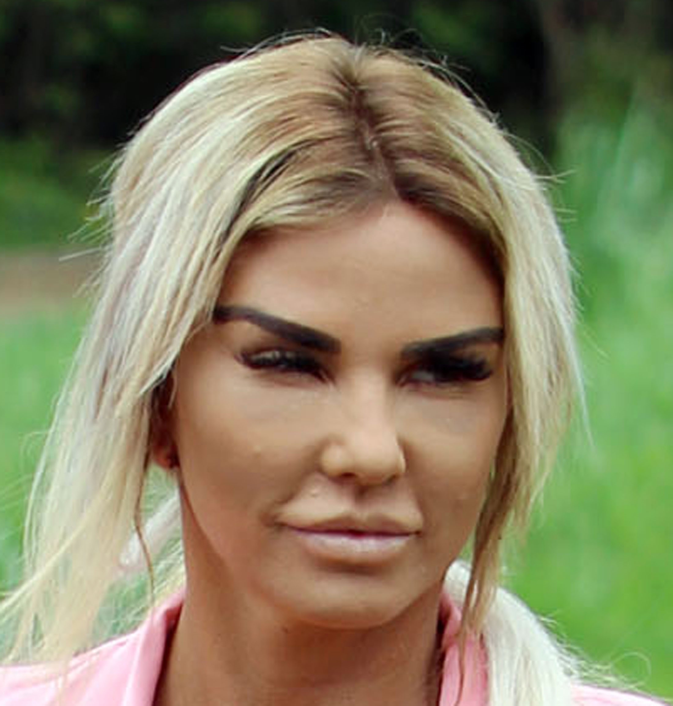 katie price face surgery