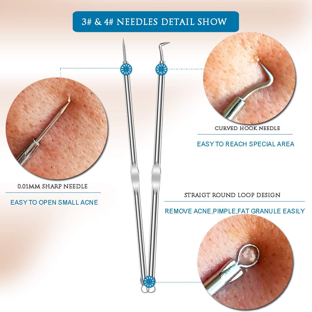 comedone extractor whiteheads