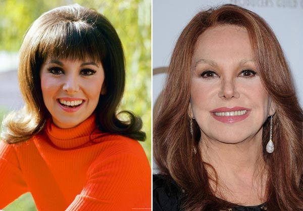 marlo thomas before and after plastic surgery