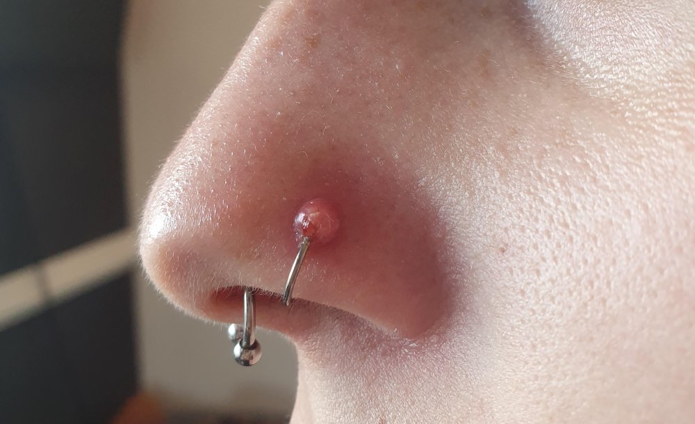 irritation bump nose piercing