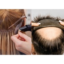 non surgical hair replacement in pune