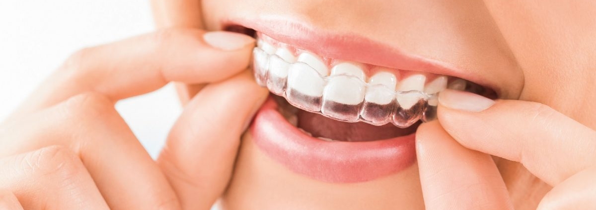 invisalign doctor site