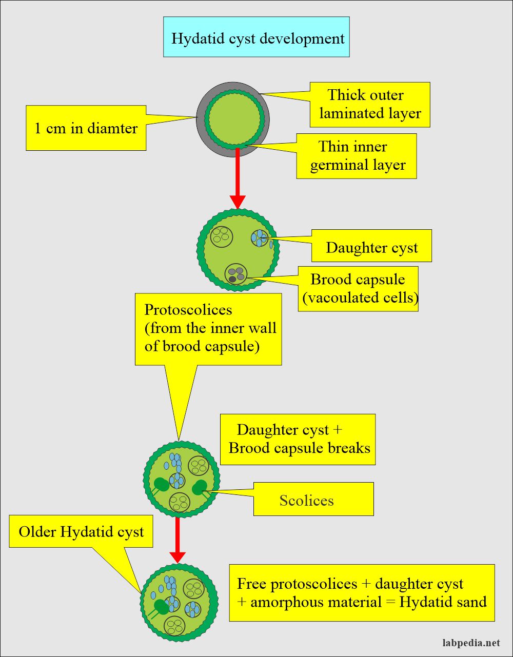 what is hydatid cyst