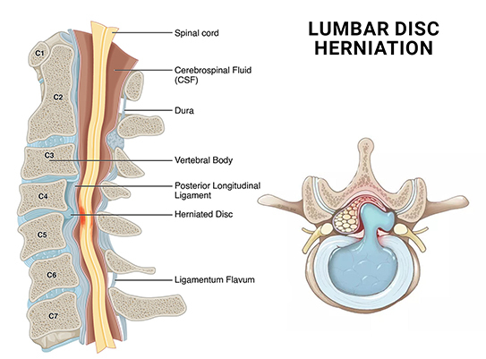 stabbing pain in upper back right side