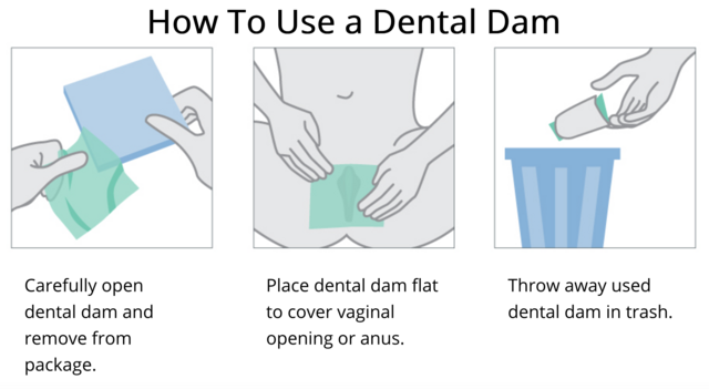 dental dam nedir