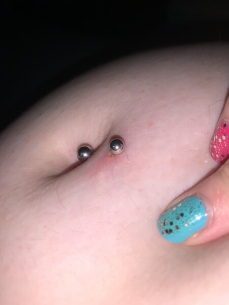 belly button ring infection