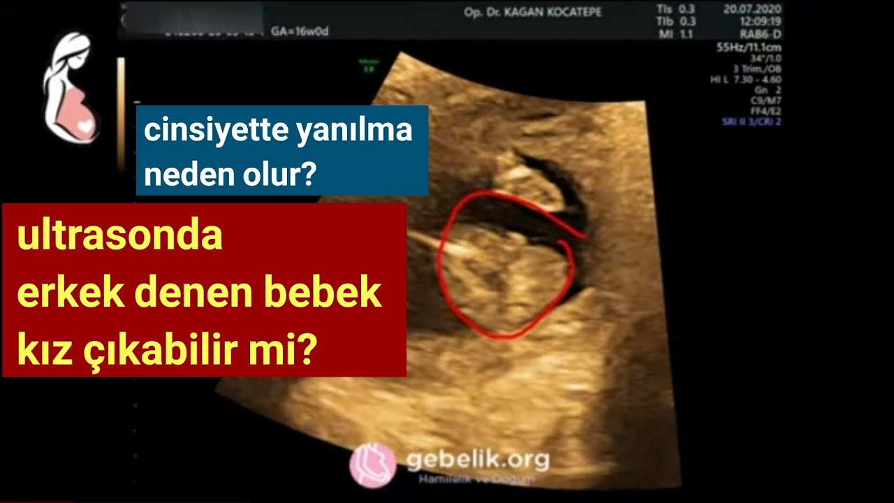 erkek bebek ultrasonda nasil durur