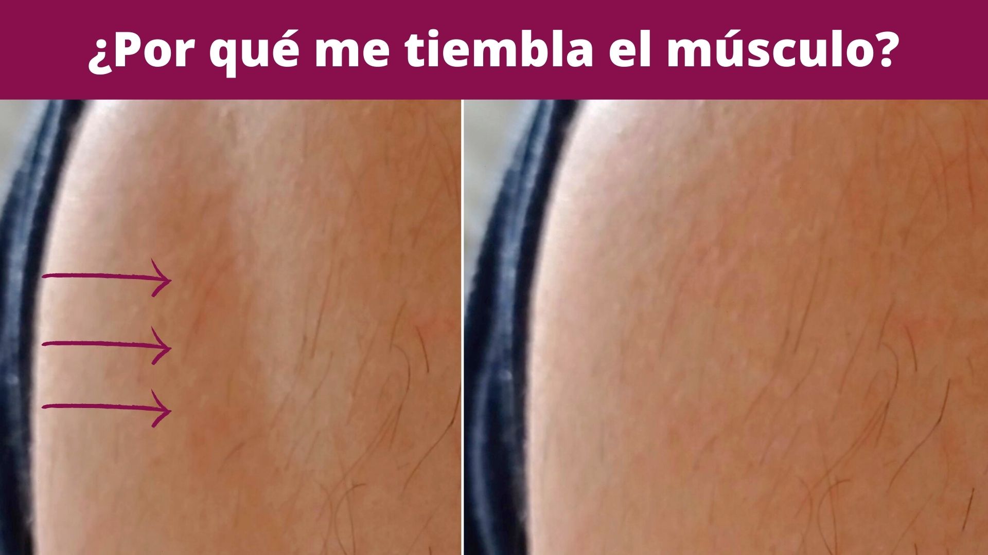 porque tiemblan los musculos en reposo