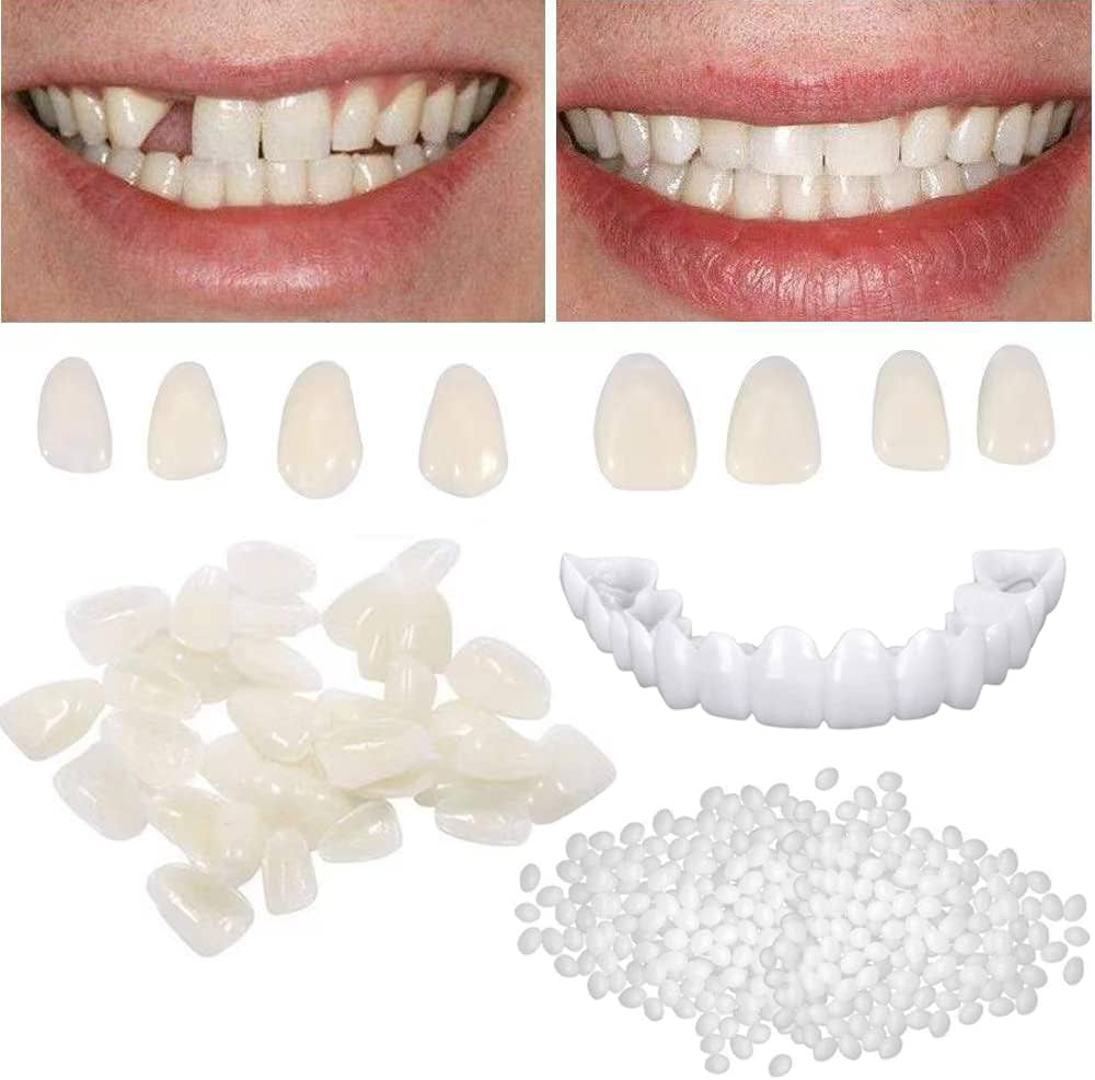 cracked tooth repair kit