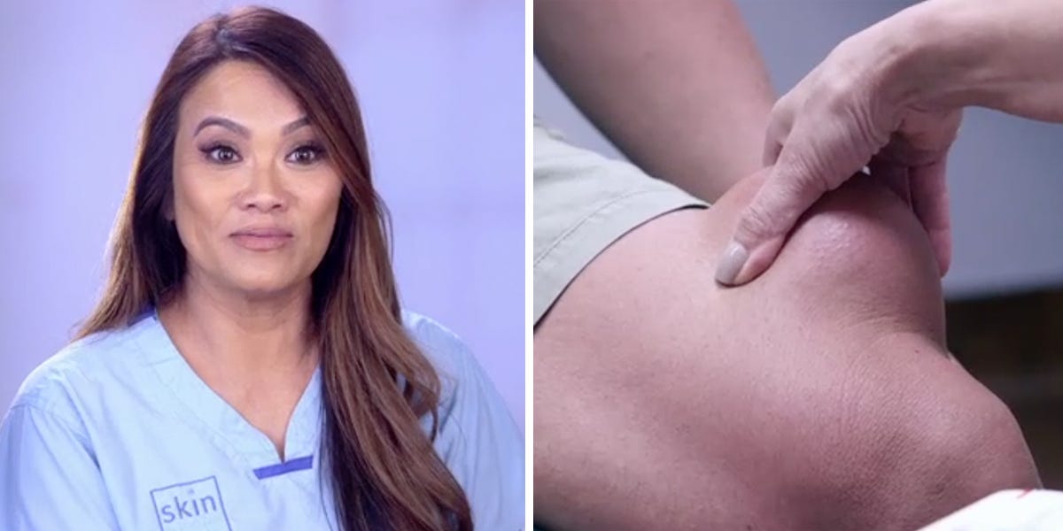 dr pimple popper episodes