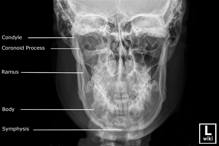 mandible anatomy radiology