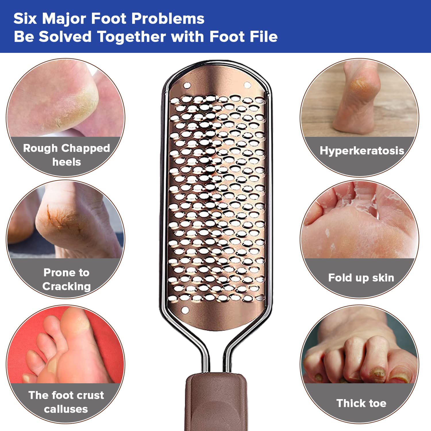 foot hard skin scraper