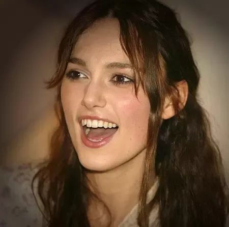 keira knightley underbite