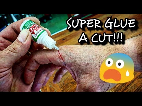 krazy glue for cuts