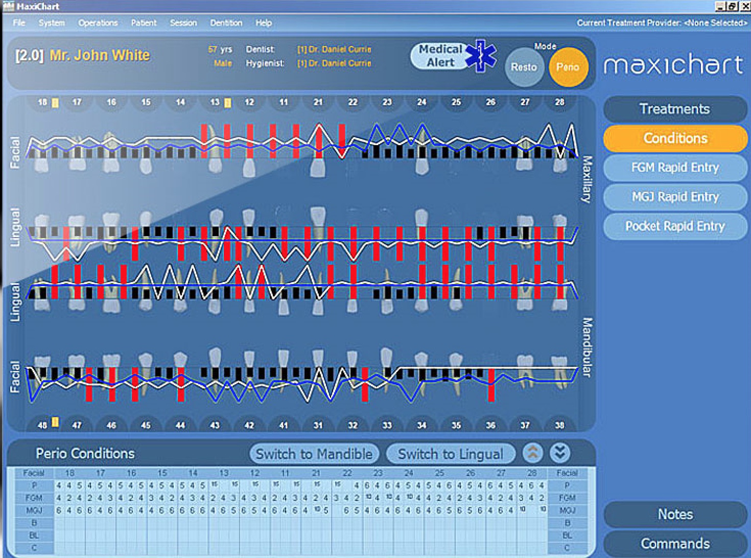 maxident software