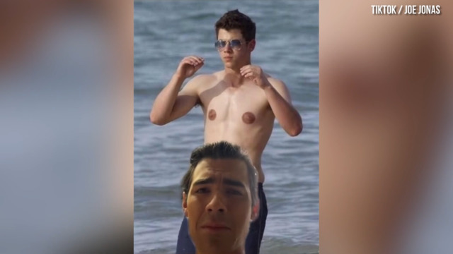 nick jonas nipples