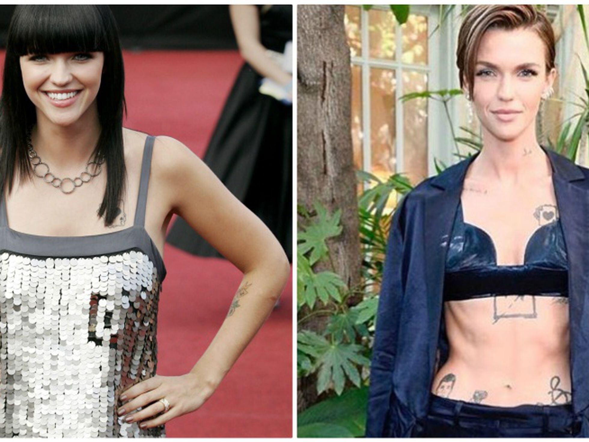 ruby rose plastic surgery