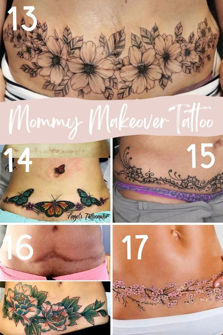 tummy tuck tattoo