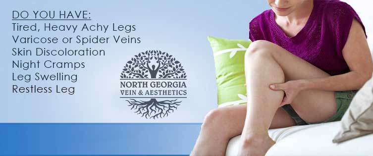 varicose veins peachtree city