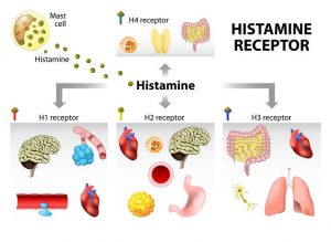 what does a histamine dump feel like